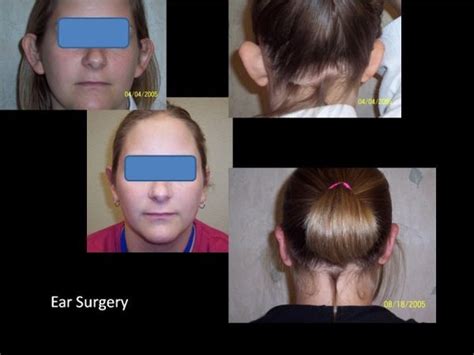 Tampa Plastic Surgery And Plastic Surgeon Arviv Medical Aesthetics