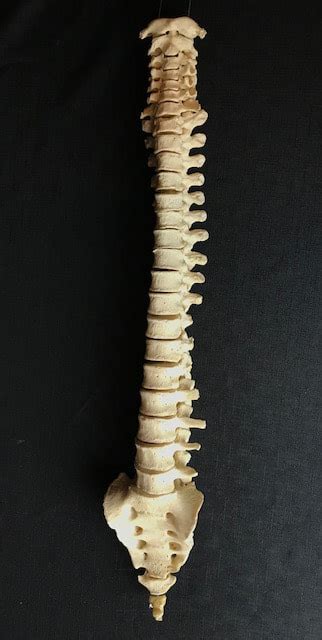 It also covers some common conditions and injuries that can affect the back. Spinal column with sacrum