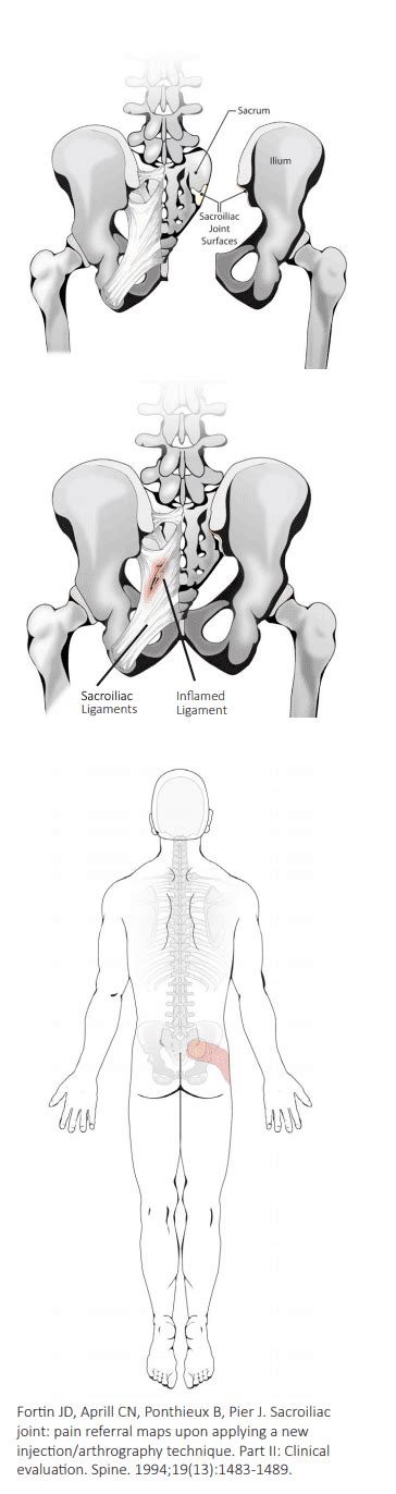 Sacroiliac Joint Injection Highland In Kanuru Interventional Spine And Pain Institute