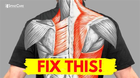How To Fix Muscle Pain Between Your Shoulder Blades For Good Spinecare