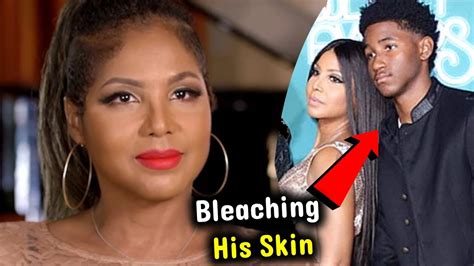 Toni Braxtons Son Denim Accused Of Bleaching His Skin Before And After
