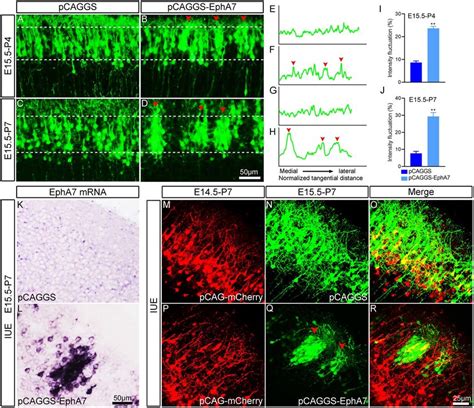 Overexpression Of EphA7 In Cerebral Cortex Results In Soma Clumping And