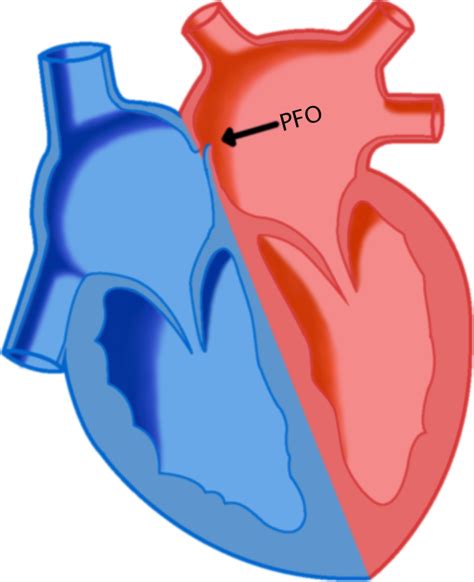 Cardia Inc Pfo Information