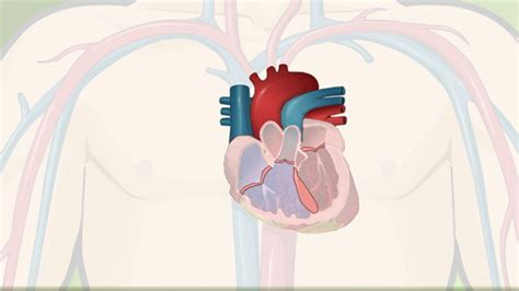 HIE Multimedia - Eisenmenger syndrome