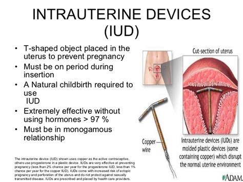 This means that only five women per 1000 once you insert the iud, it will work without any action needed from the woman. Contraception presentation