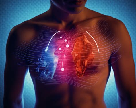 Marcadores cardíacos en el diagnóstico de la angina de pecho