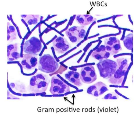 Gram Positive Bacilli Rods And Diseases Microbe Online