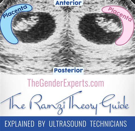 The Ramzi Theory Can Predict Babys Gender As Early As 6 Weeks The