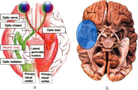 Human Visual System A Schematic Of The Visual Wiring In The Brain