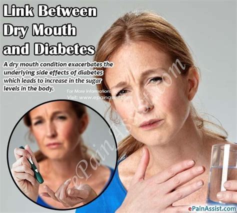 Dry Mouth And Diabetes Diabetestalk