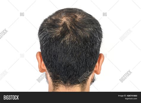 Back View Mens Head Image And Photo Free Trial Bigstock