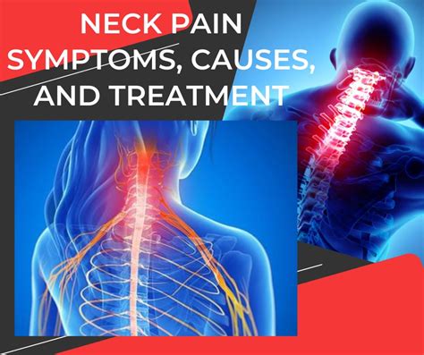 Neck Pain Symptoms Causes And Treatment