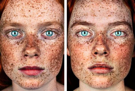 Brock Elbank Shoots Follow Up Portrait Of Face Behind The Freckles