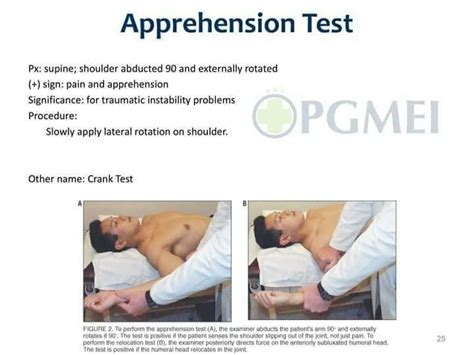 Apprehension Test Physio How To Apply Physiotherapy