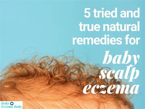 5 Best Home Remedies For Eczema On The Scalp Itchy Eczema Baby