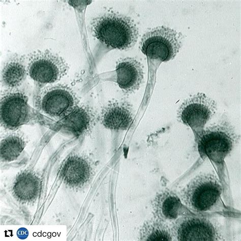 Repost Cdcgov ・・・ Aspergillus Is A Type Of Mold That Lives In The
