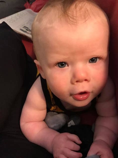 This special fish test for 22q11.2 deletions is available in many clinical laboratories that look at chromosomes (referred to as cytogenetics. Meet Amos, 9m, "born with TOF & overriding aortic arch ...
