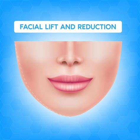 White female face before after plastic surgery jaw reduction and botox