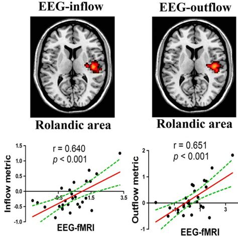 Localization Of Rolandic Focus By Gcd In Bects Abbreviations Gcd