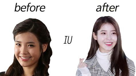 Iu Before And After Youtube