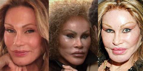 Jocelyn Wildenstein Plastic Surgery Before And After Face Photos