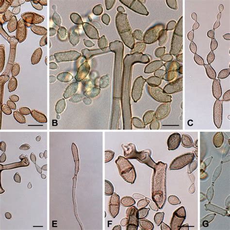 Pdf Biodiversity In The Cladosporium Herbarum Complex Davidiellaceae