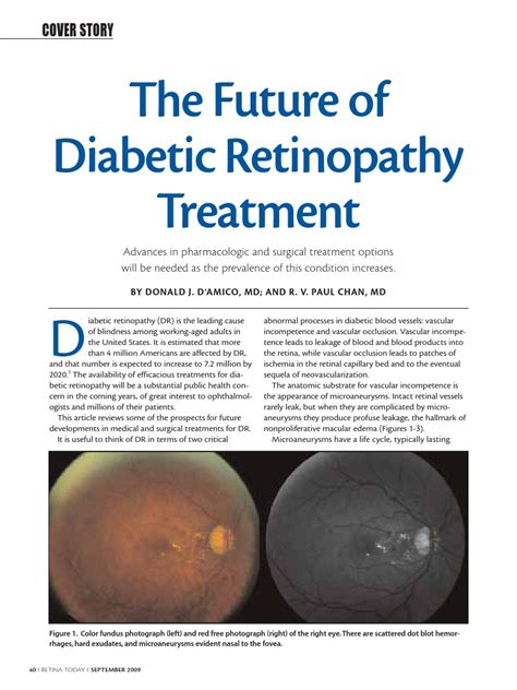 The Future Of Diabetic Retinopathy Treatment Retina Vascular