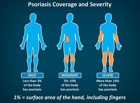 Diagnosis Psoriasis Thrive