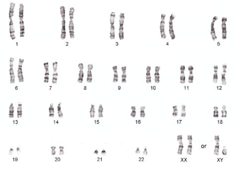 genetics - The human has 46 double chromosomes or simple chromosomes ...
