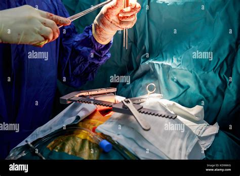 Open Heart Cardiac Bypass Surgery In Operation Room Open Heart Surgery