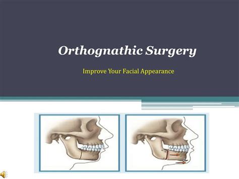 Ppt What Is Orthognathic Surgery Powerpoint Presentation Free