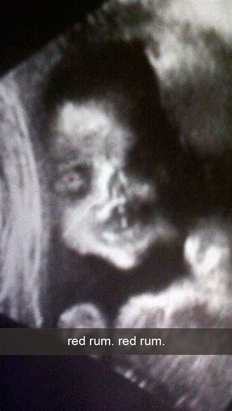 This One Is Creepy 0 0 17 Snapchats From Fetuses Fetal Development