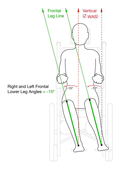 Technical Illustration Clinical Wheelchair Seating And Positioning