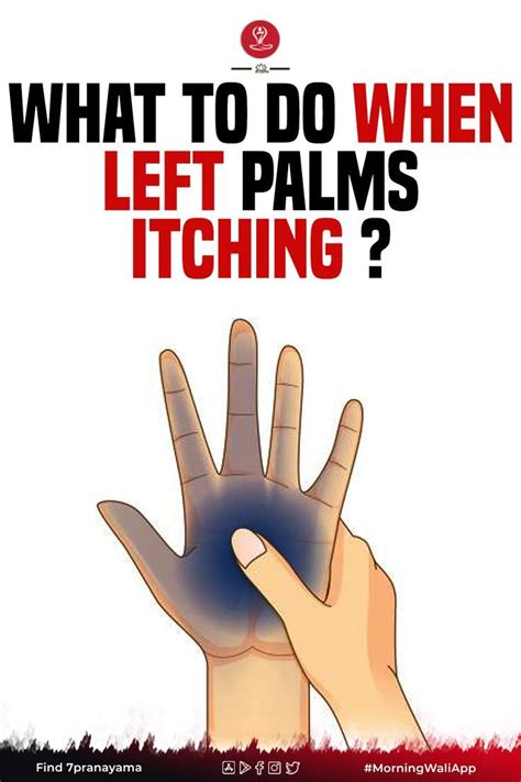 Palms Itching Itchy Right Palm Itchy Left Palm Artofit
