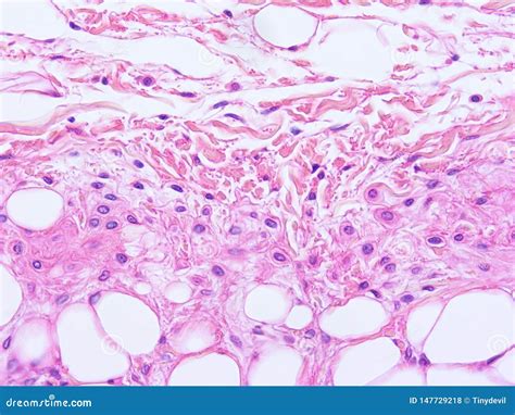 Histologia Do Tecido Humano Do Epiglote Foto De Stock Imagem De