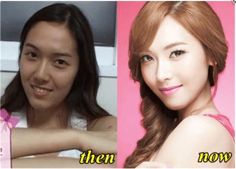 Snsd Plastic Surgery Before