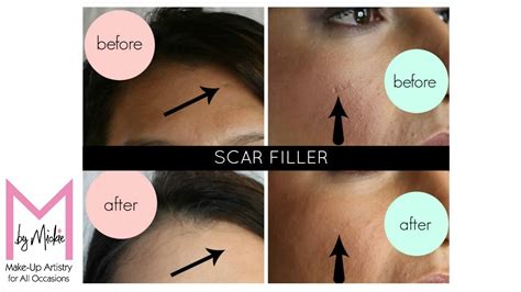 Scar Filler Makeup Tutorial Pics