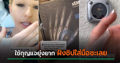 สาวฝังชิปใส่มือ อยากให้ชีวิตสะดวก ปลดล็อกได้ง่าย ๆไม่ต้องใช้กุญแจแล้ว