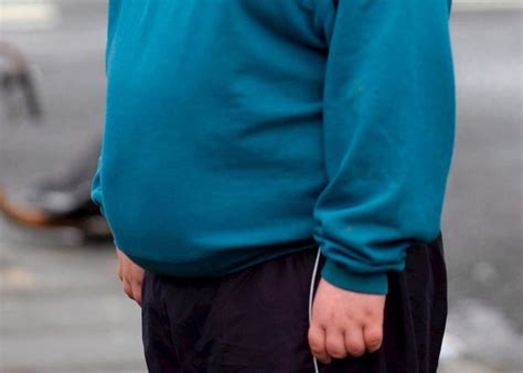Preocupa La “epidemia” De Obesidad En Niños Catamarca Actual