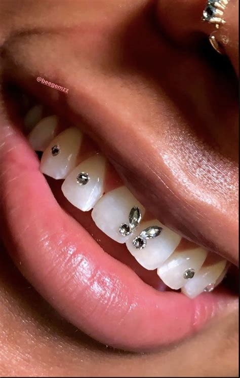 Butterfly Teeth Jewelry Diamond Teeth Tooth Gem