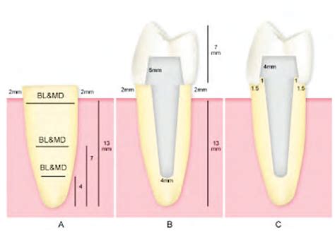 A View Of Tooth Structure Measurements 1 Through 5 Schematic