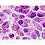 No 40 Reticulum Cells Macrophages Plasma And Mast 