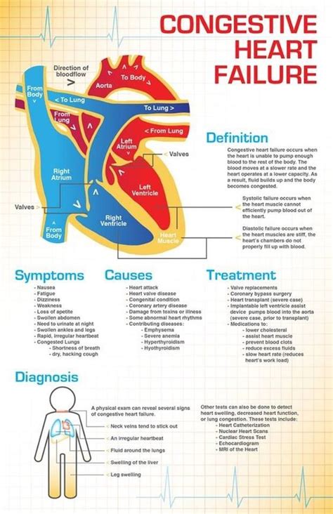 Congestive Heart Failure Infographic Phartoonz