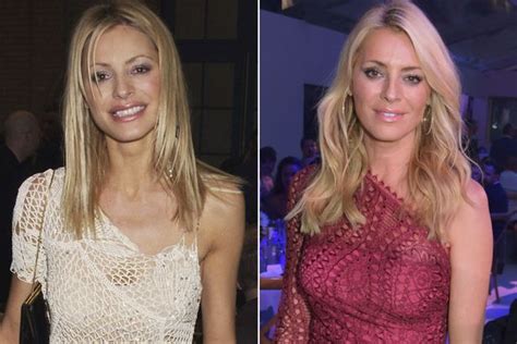 Tess Daly S Changing Face How The Strictly Come Dancing Host Keeps Her Youthful Glow Irish