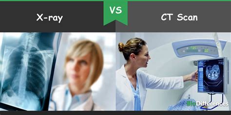 Difference Between X Ray And Ct Scan Bio Differences