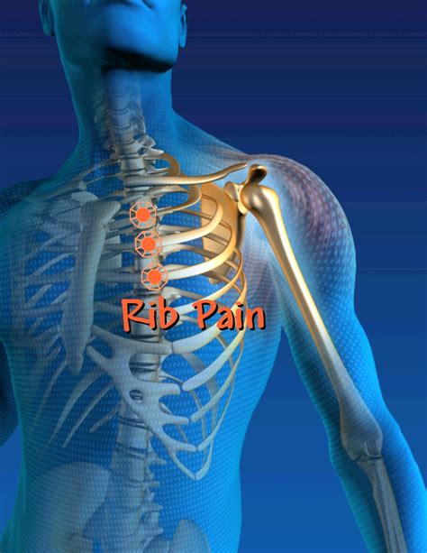 Rib Pain As Costochondritis Innova Pain Clinic