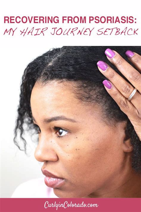 Hair from the scalp, as well. Recovering from Psoriasis: My Hair Journey Setback - Curly ...