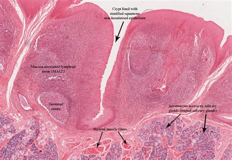 Tonsil Histology