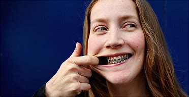 Emine Saner How Does It Feel To Wear Braces As An Adult Life And