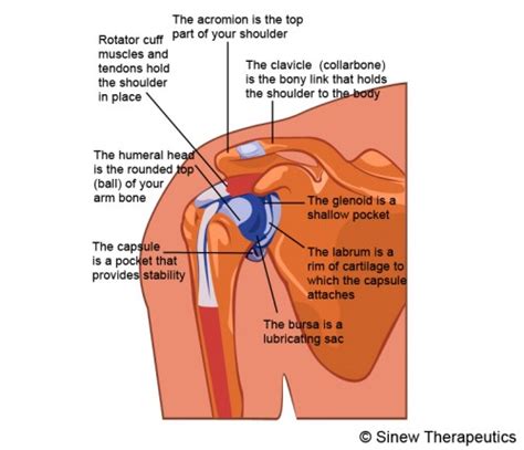 By definition shoulder impingement syndrome was considered, subacromial outlet obstruction resulting in irritation of the supraspinatus tendon. Impingement Syndrome-Swimmers Shoulder Throwers Shoulder ...